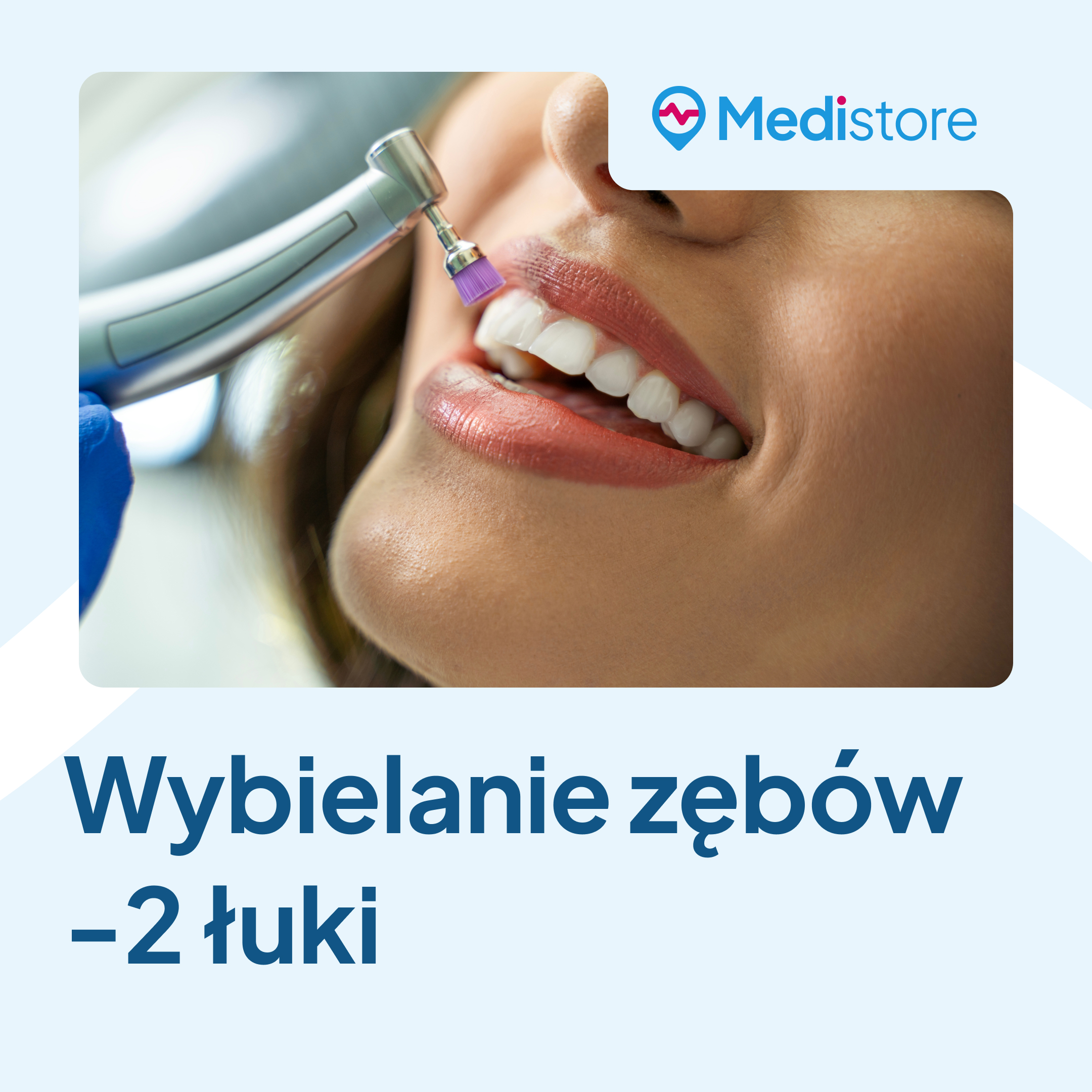 Wybielanie zębów - 2 łuki