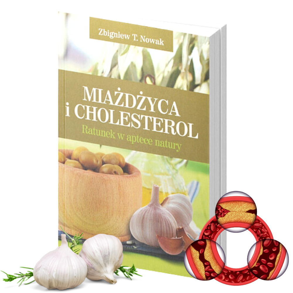 Miażdżyca i cholesterol – Zbigniew T. Nowak