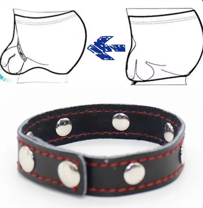 Pierścień na mosznę 152