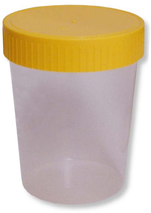 Pojemnik na mocz z nakrętką , niesterylny, 100ml, 1 sztuka