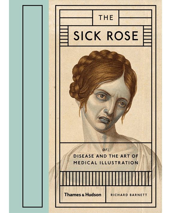 The Sick Rose. Disease and the Art of Medical Illustration