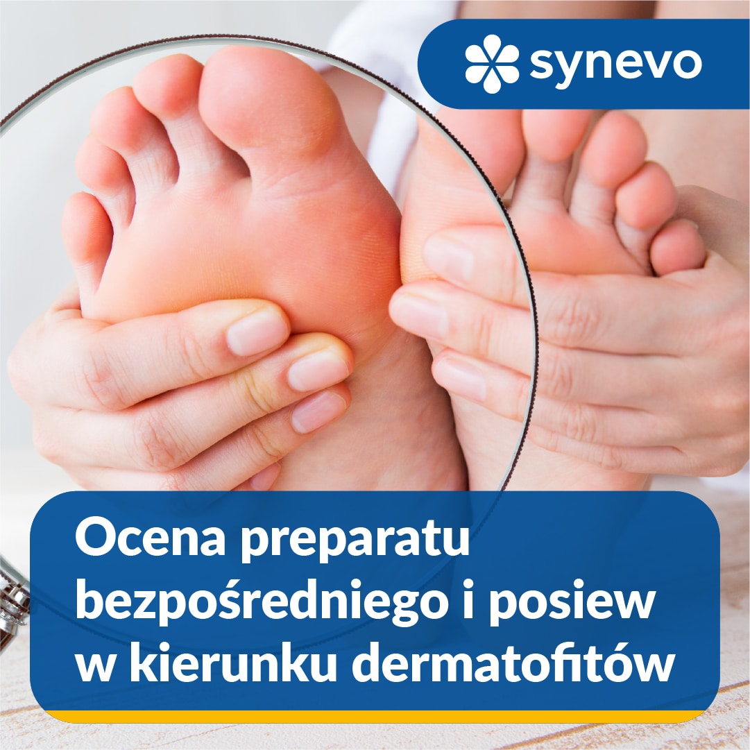 Ocena preparatu bezpośredniego oraz posiew w kierunku dermatofitów