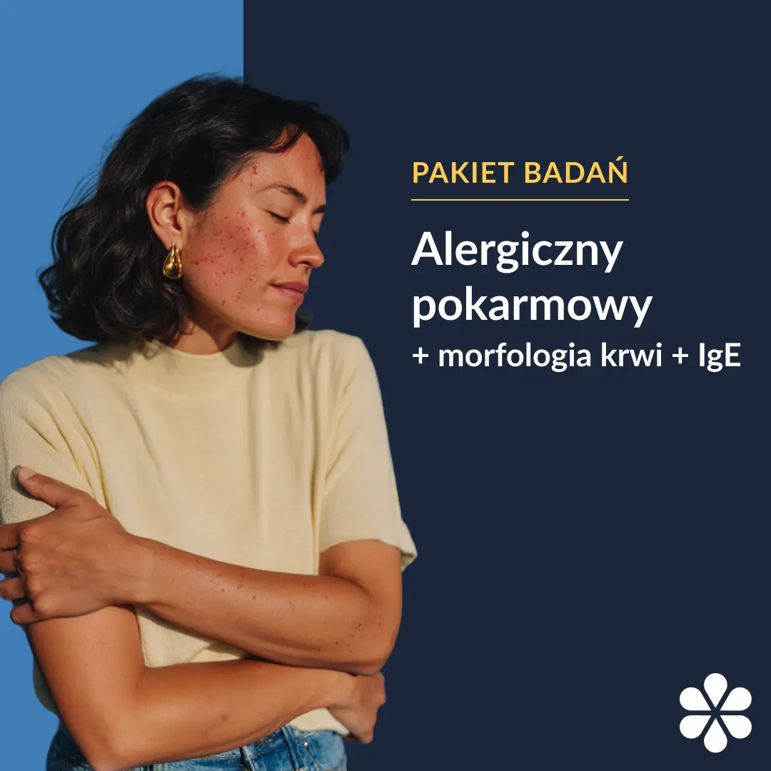 Pakiet badań - alergiczny pokarmowy (20 alergenów)