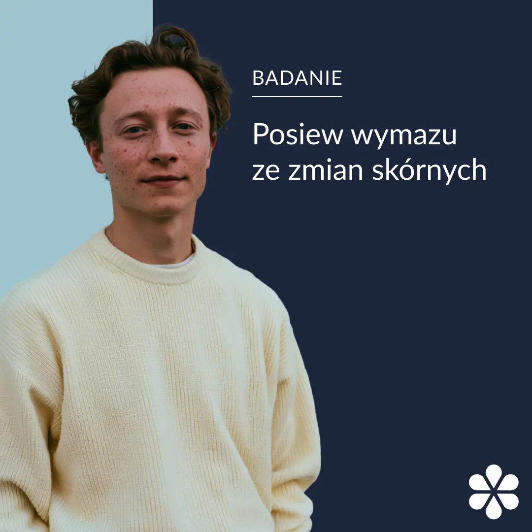 Posiew wymazu ze zmian skórnych
